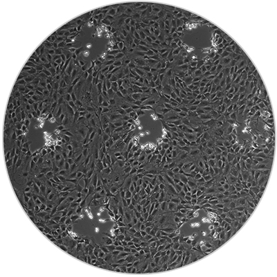 Perform Reproducible Cell Migration Assays